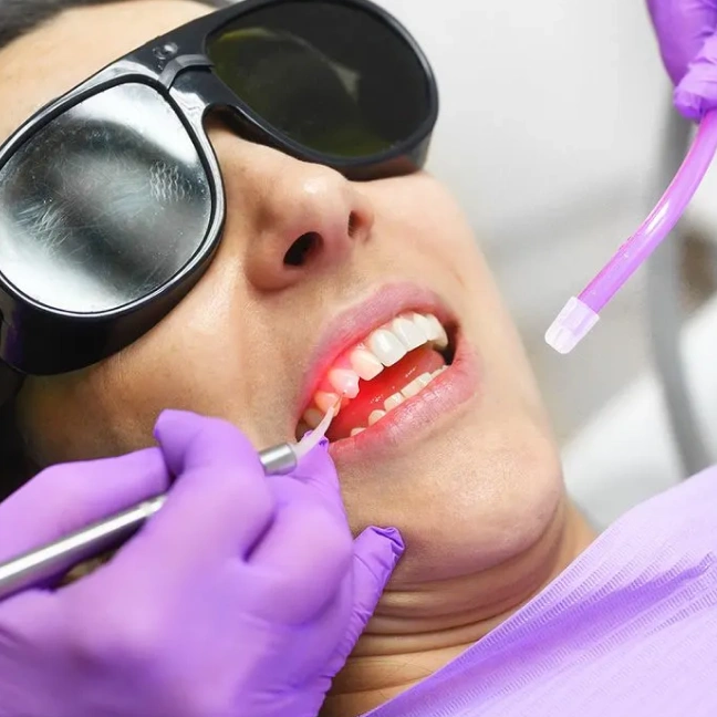 Advanced laser dental treatment for precise care
