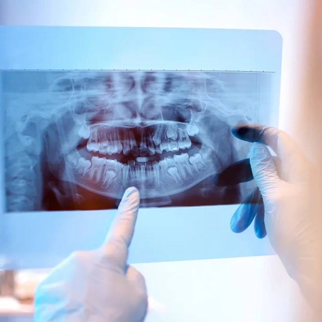 Why might I need oral surgery?