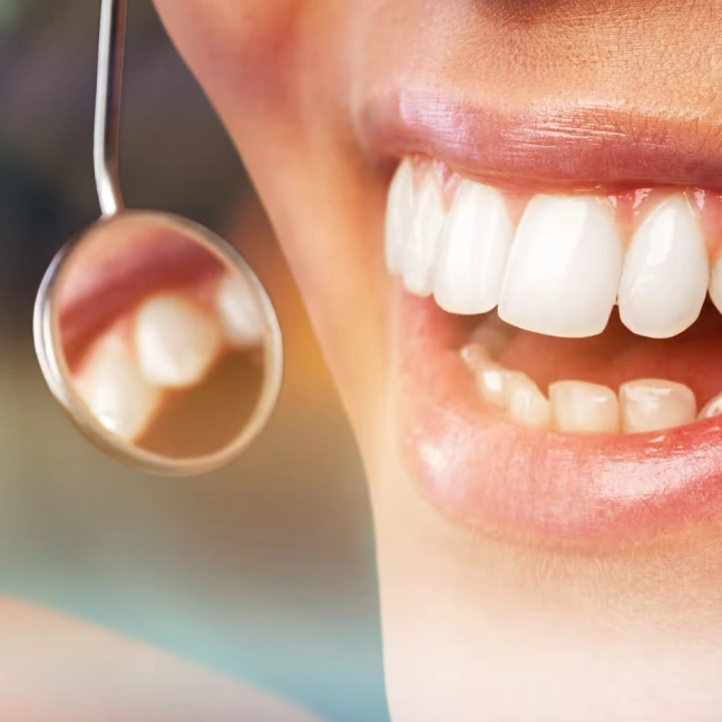 Dental insurance, simplified