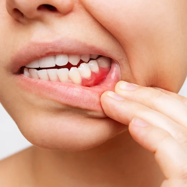 Periodontal Care
