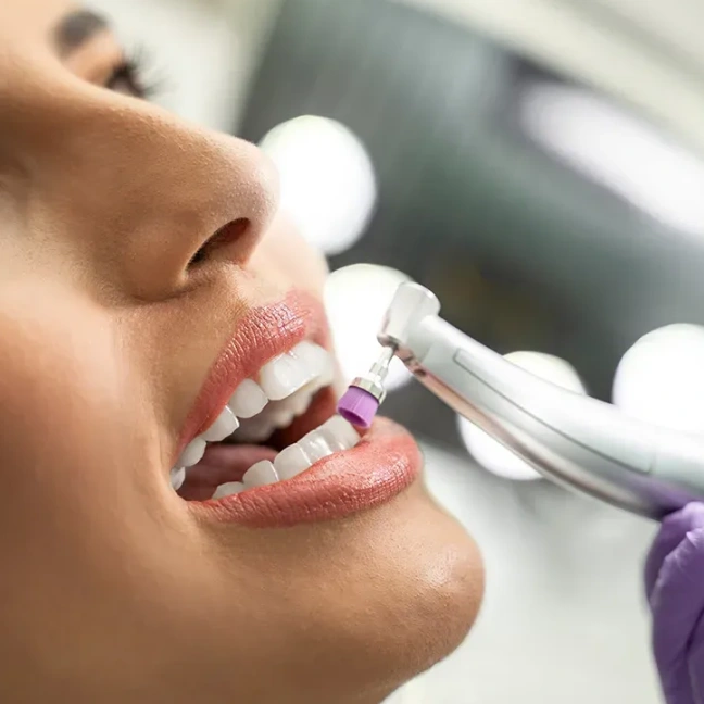 Professional dental cleaning for healthy teeth and gums