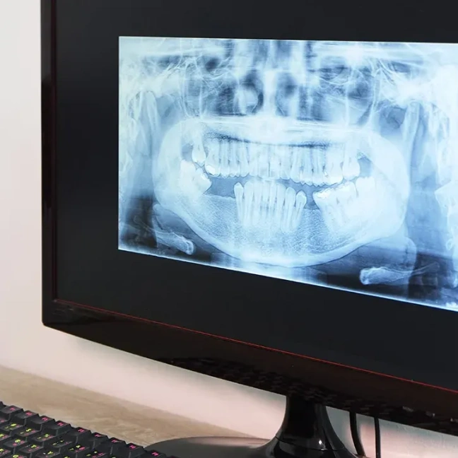Digital dental X-ray for preventive oral care