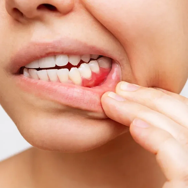 Periodontal Care