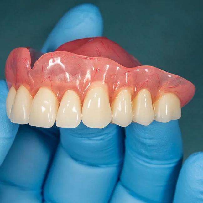 Precision restorative dental procedure