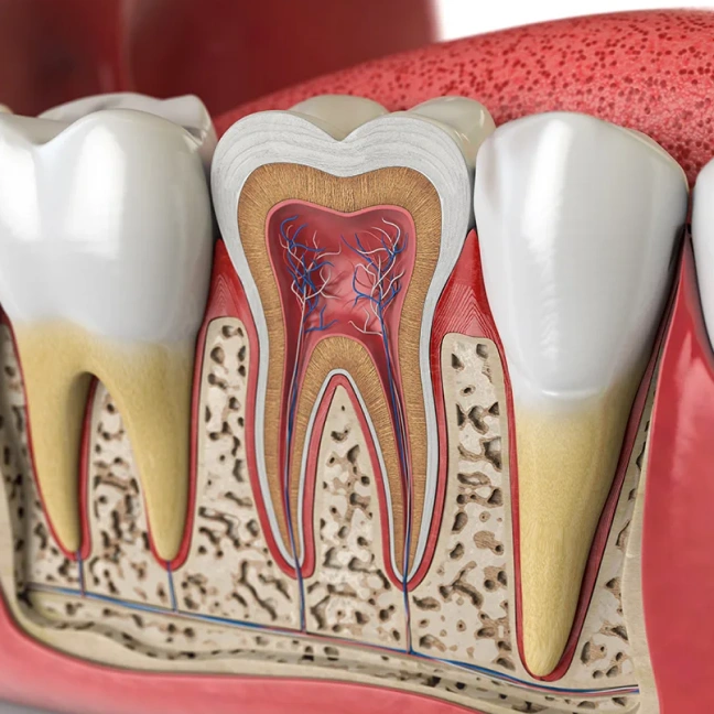 Root Canal Therapy