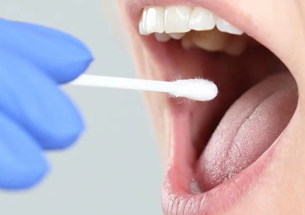 Patient testing her Saliva