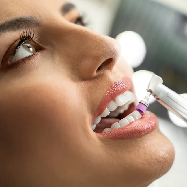 Professional dental cleaning to maintain healthy teeth and gums