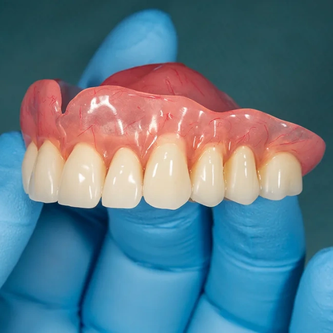 Full denture restoration designed to replace missing teeth
