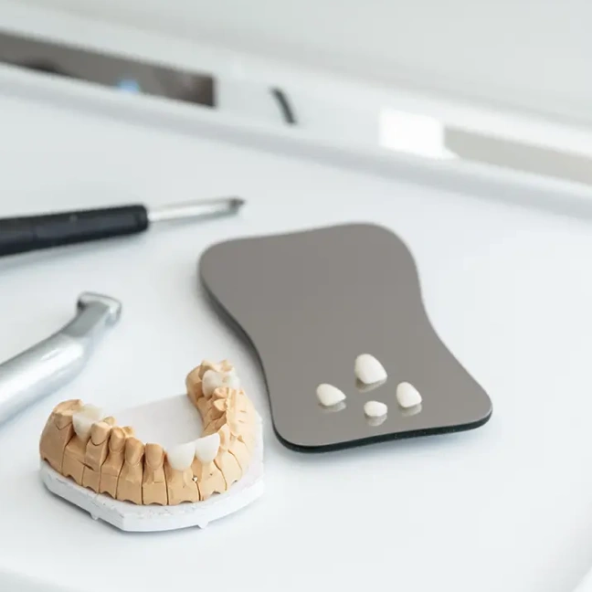 Lumineers veneers displayed with cosmetic dental tools