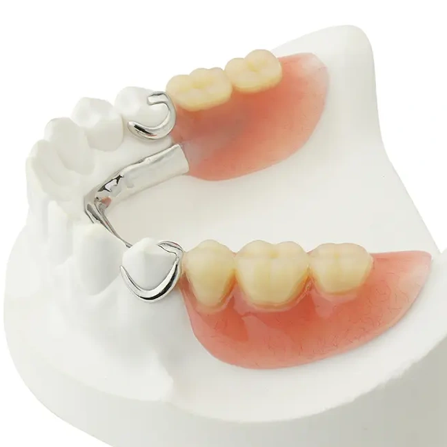 Removable partial denture with replacement teeth